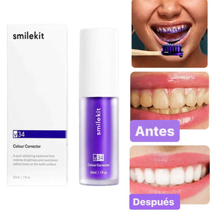 BLANQUEADOR DENTAL ECUOSHOP